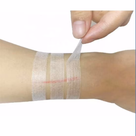 Wound Skin Closure Steri-Strip Adhesive Tape Sterile Skin Closure Tape Less Posting Medical Adhesive Tape Manufacturer