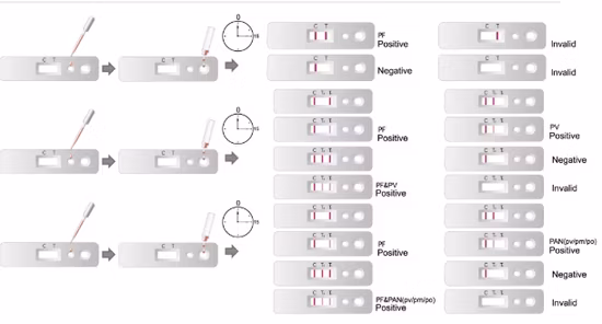 Factory Price Wholesale One Step Mpxv Igg/Igm Test with CE
